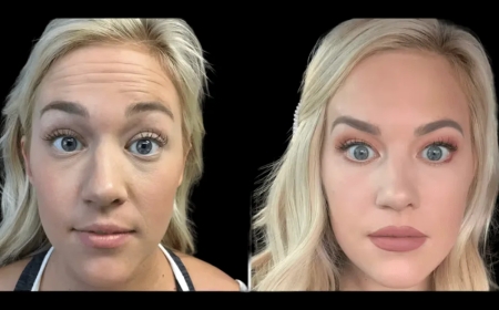 Celebrity Beauty Treatments Offered by the Best Aesthetic Clinic in Dubai