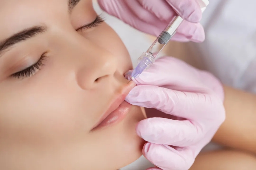 What to Expect During Your Lip Fillers Appointment