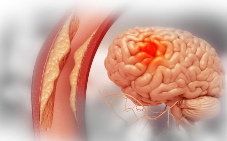 Unlock New Insights in Stroke Research: Ace Therapeutics Announces Behavioral Tests in Rodent Models of Stroke