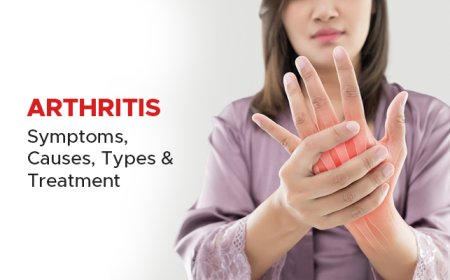 What Causes Arthritis Disease & Types, Treatment