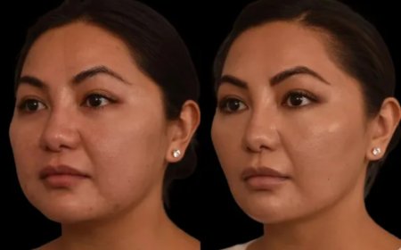 Best Double chin removal Surgeons in Dubai on Managing Expectations