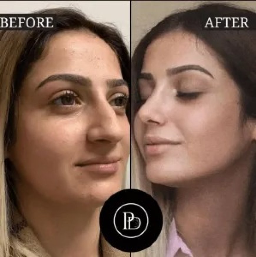Board-Certified and Trusted: Dubai Best Plastic Surgeon