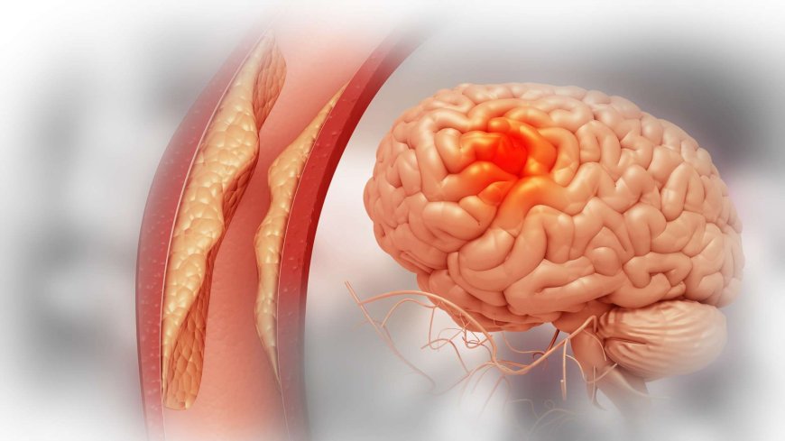 Unlock New Insights in Stroke Research: Ace Therapeutics Announces Behavioral Tests in Rodent Models of Stroke