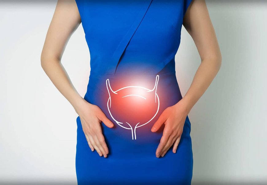 Bladder Health: Tips for Preventing Common Urological Issues